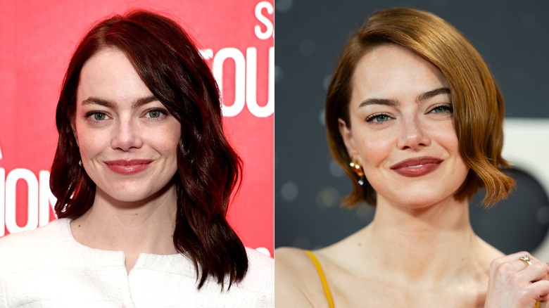 Emma Stone before and after cosmetic procedures in 2025