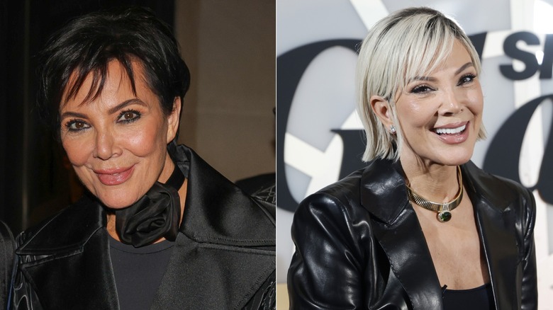 Kris Jenner before and after 2025 facelift