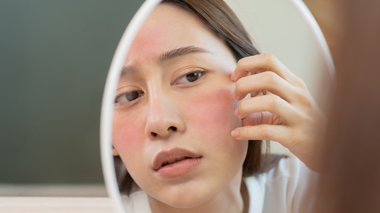 Woman with rosacea looking at face mirror