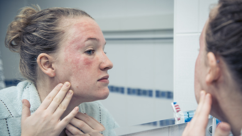 Woman looking at face irritation in mirror