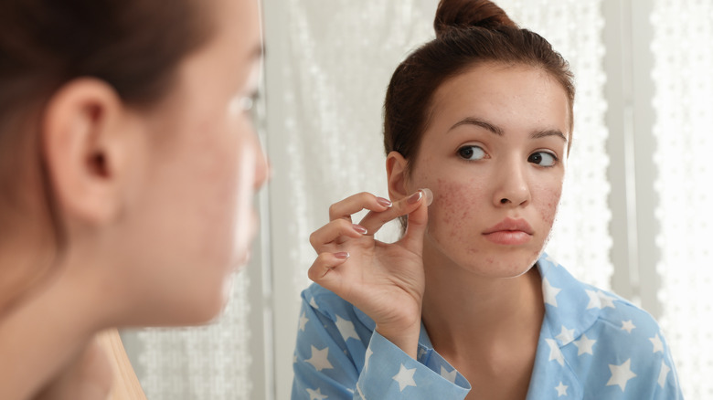 Woman sticking on pimple patch