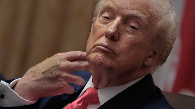 Donald Trump showing off his bandaged hand as he scratches his face