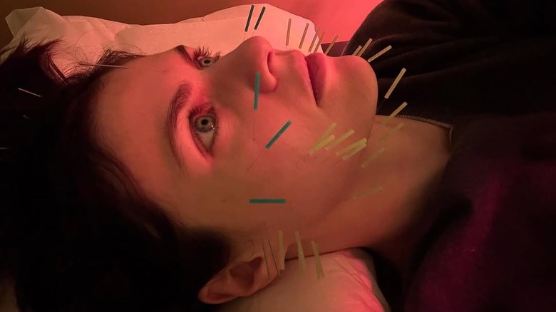 Alexandra Daddario with acupuncture needles in her face