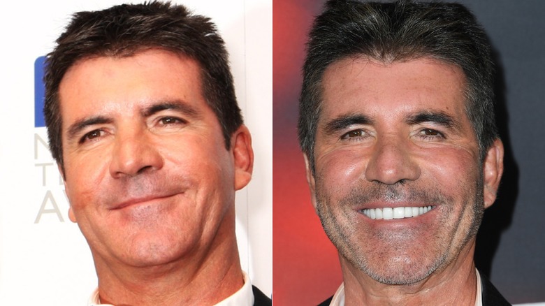 Side-by-side photos of Simon Cowell