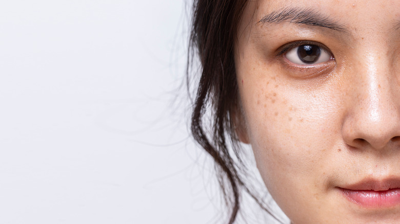 Woman with freckles