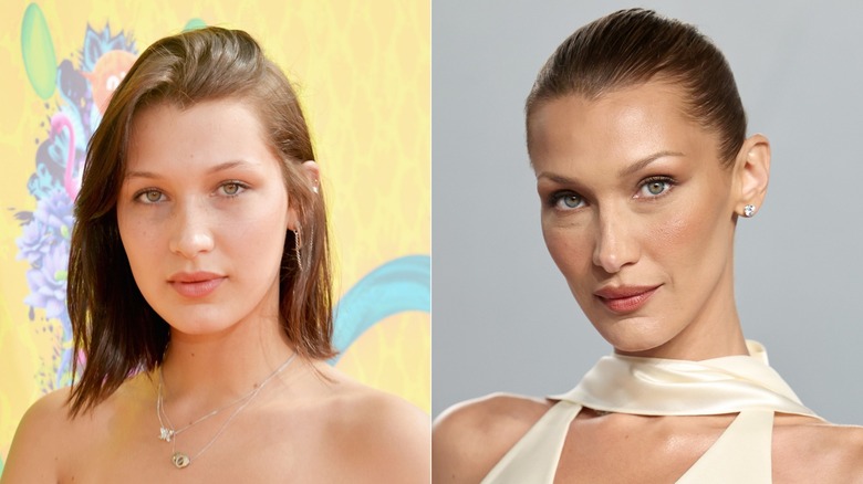 Bella Hadid before and after