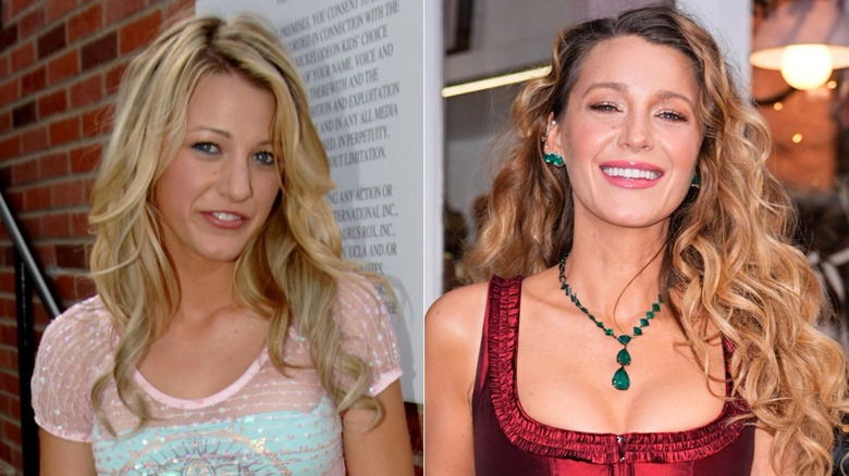 Blake Lively before and after