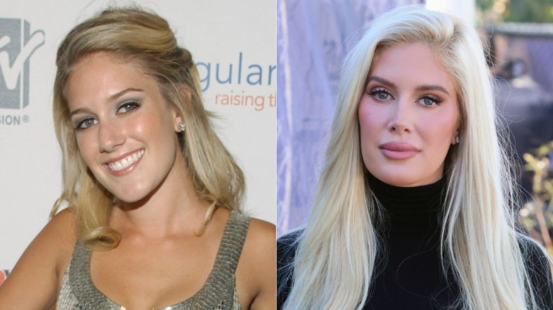 Heidi Montag before and after