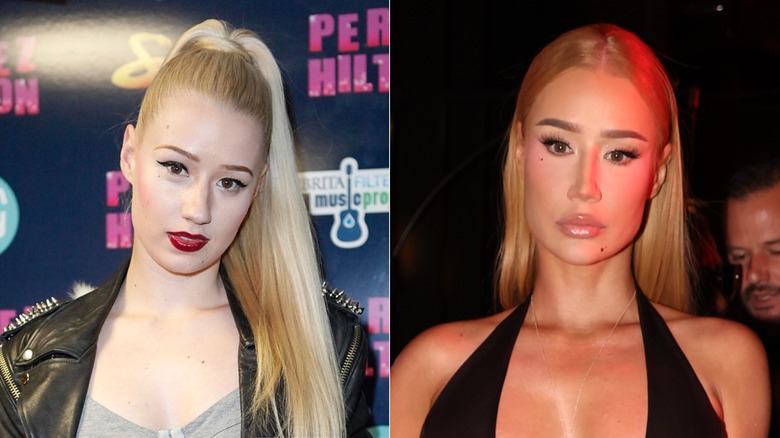 Iggy Azalea before and after