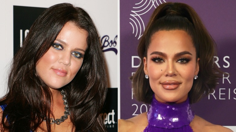 Khloé Kardashian before and after