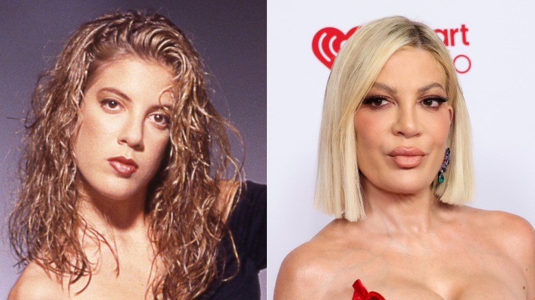 Tori Spelling before and after