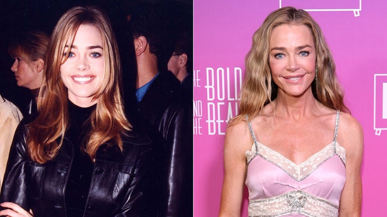 Split image of Denise Richards before and after