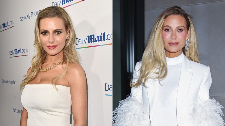 Split image of Dorit Kemsley before and after