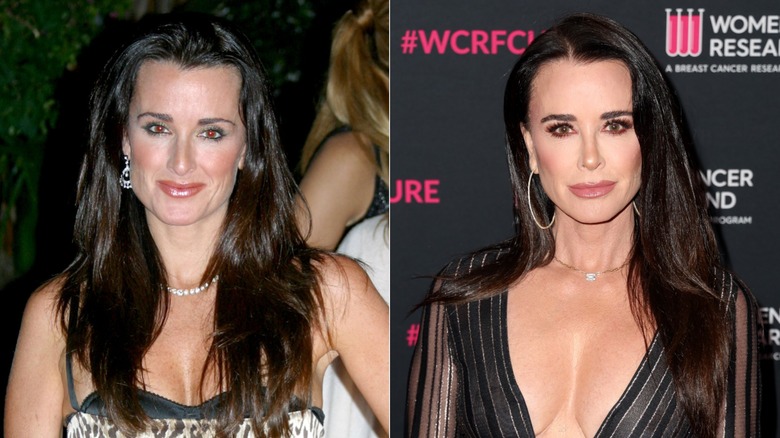 Split image of Kyle Richards before and after