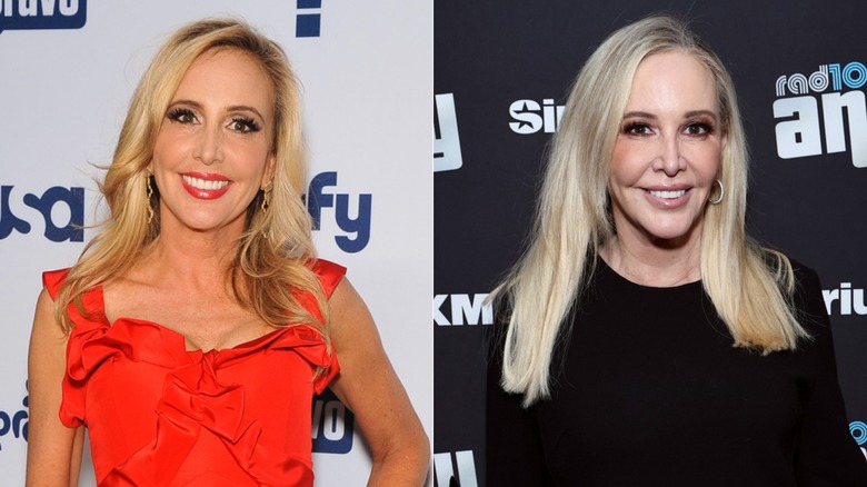 Split image of Shannon Beador before and after