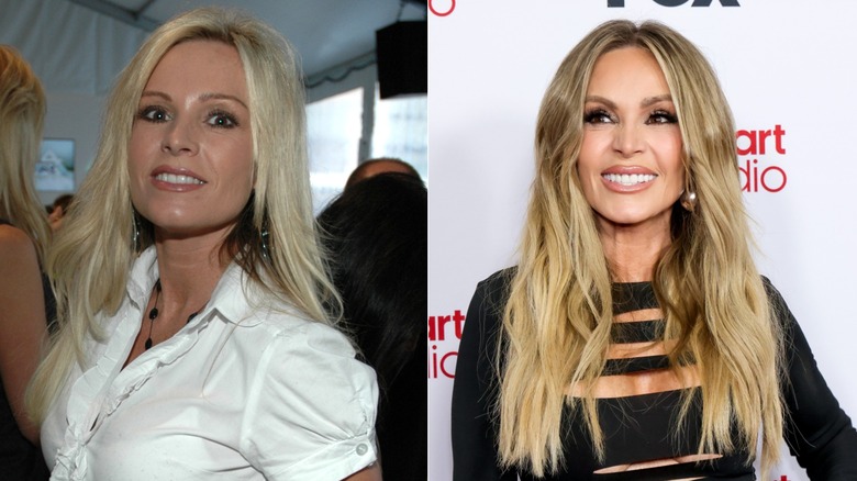 Split image of Tamra Judge before and after