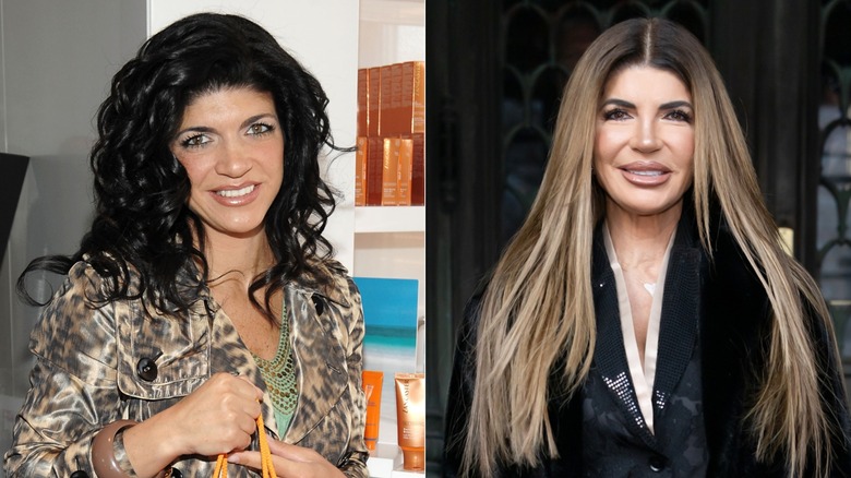 Split image of Teresa Giudice before and after