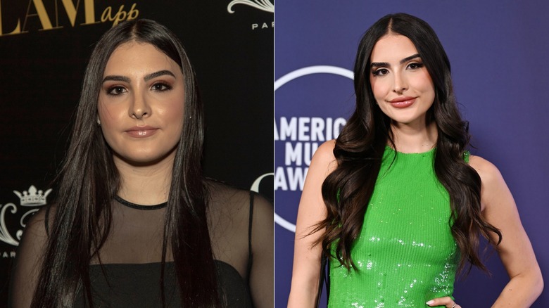 Sophia Umansky before and after Mounjaro