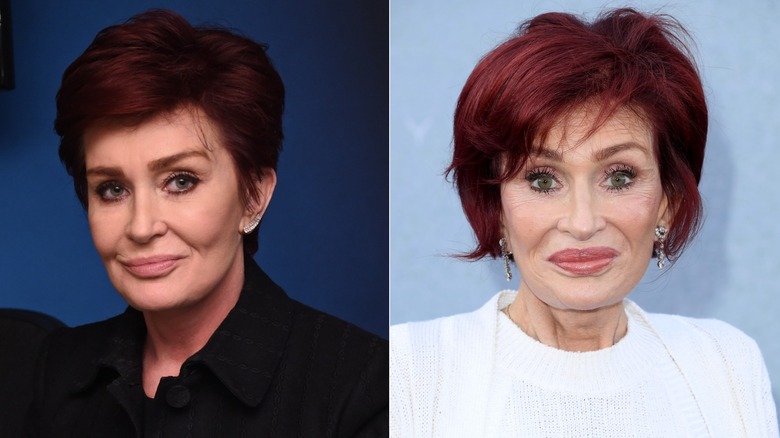 Sharon Osbourne before and after Ozempic