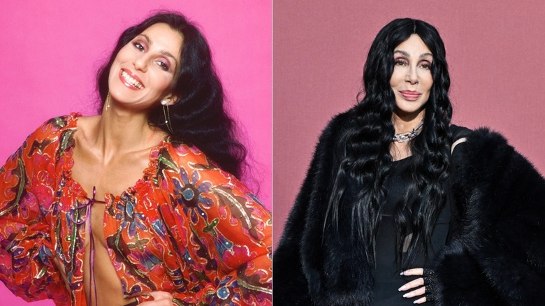 Cher before and after plastic surgery