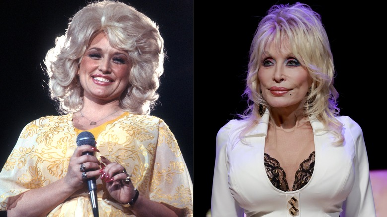 Dolly Parton before and after plastic surgery