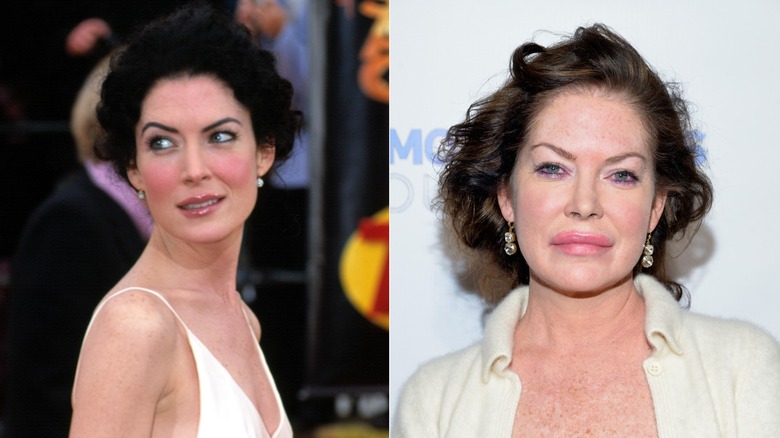 Lara Flynn Boyle before and after plastic surgery