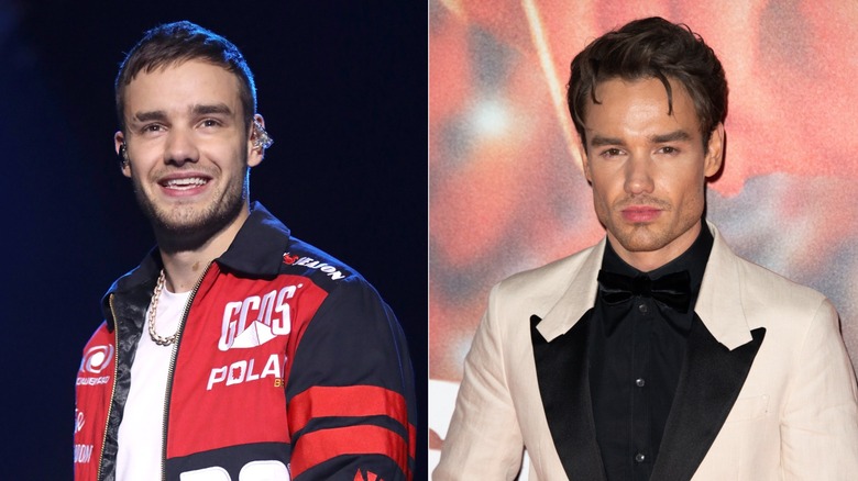 Liam Payne before and after plastic surgery