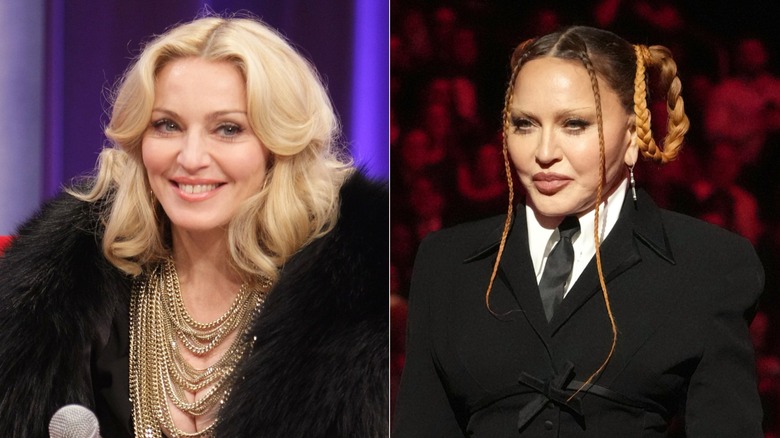 Madonna before and after plastic surgery