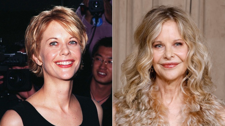 Meg Ryan before and after plastic surgery