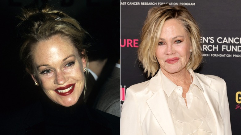 Melanie Griffith before and after plastic surgery