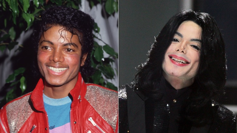 Michael Jackson before and after plastic surgery