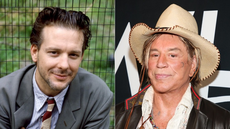 Mickey Rourke before and after plastic surgery