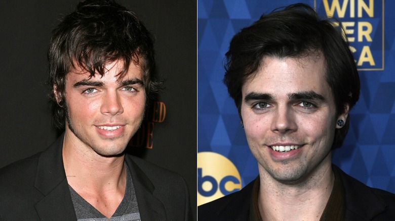 Reid Ewing before and after plastic surgery