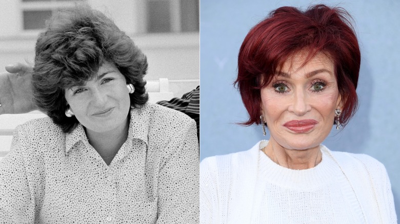 Sharon Osbourne before and after plastic surgery