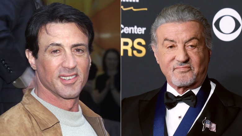 Sylvester Stallone before and after plastic surgery