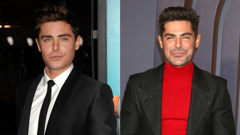 Zac Efron before and after plastic surgery
