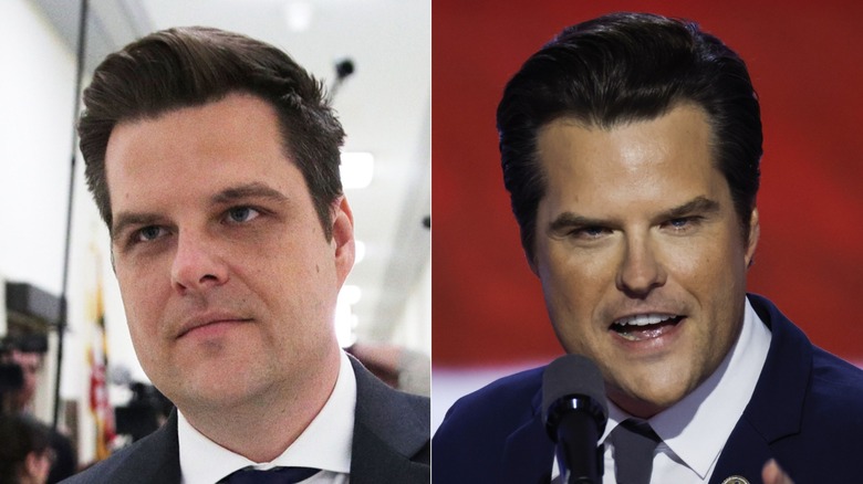 Matt Gaetz in a suit with paler skin next to close up of Matt Gaetz with tan skin, talking into a microphone.