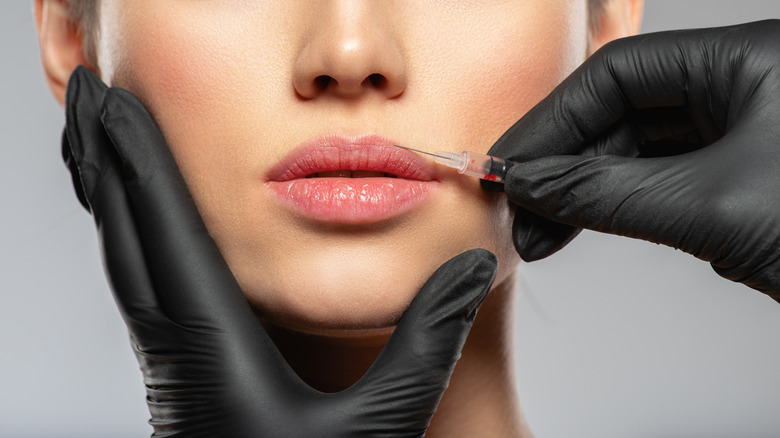 Lips being injected with needle