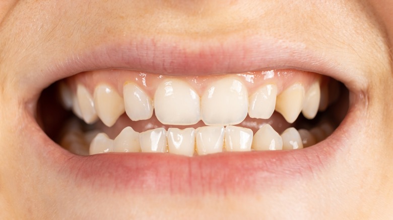 close up of mouth