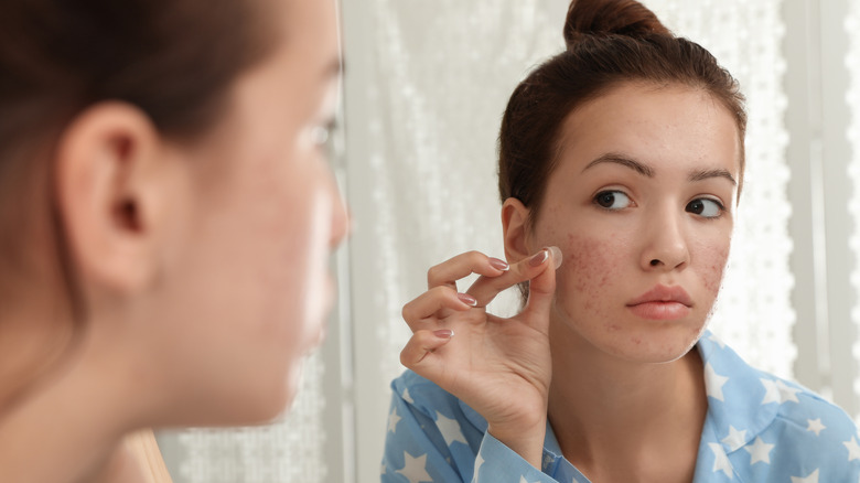 Woman looking in the mirror treating acne 