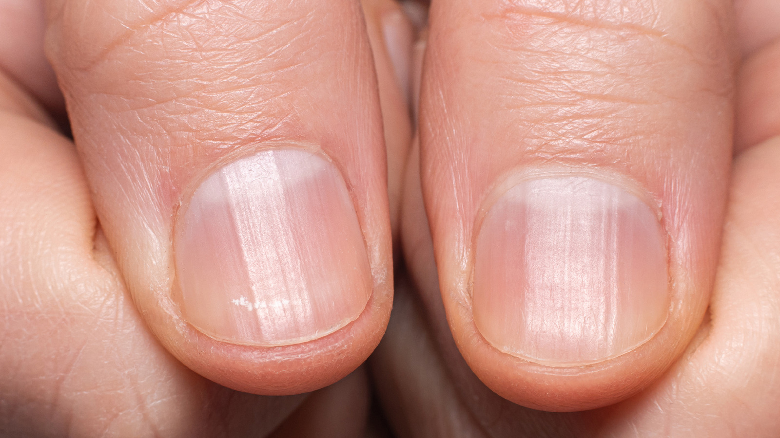 Can Vaseline Really Help Your Nails Grow Quickly?