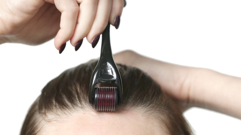 Woman using derma roller for hair loss