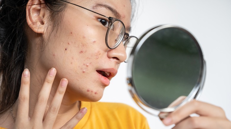 Woman with acne looking in mirror