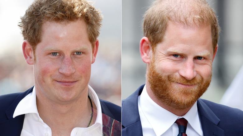 Prince Harry with and without beard