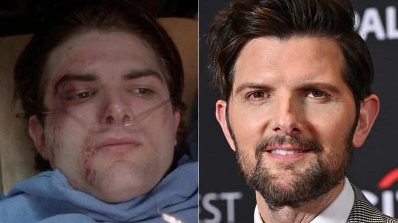 Adam Scott in "ER" vs. now