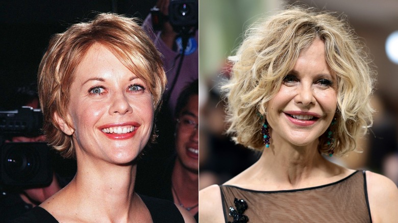 Meg Ryan before and after plastic surgery