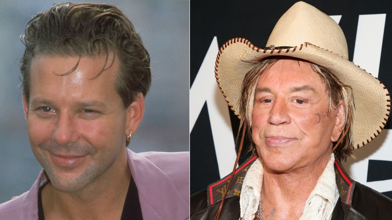 Mickey Rourke before and after plastic surgery