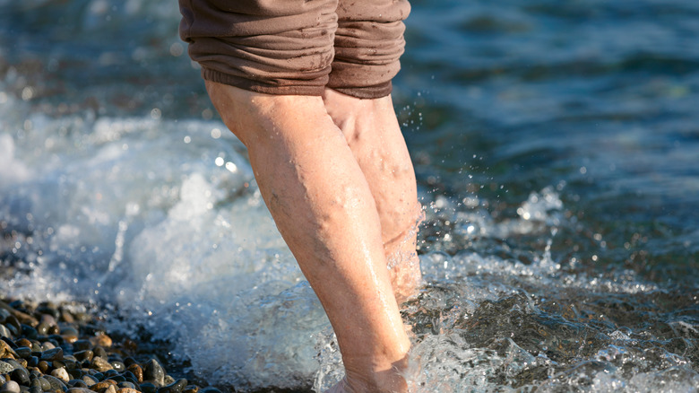 Legs varicose veins standing in water