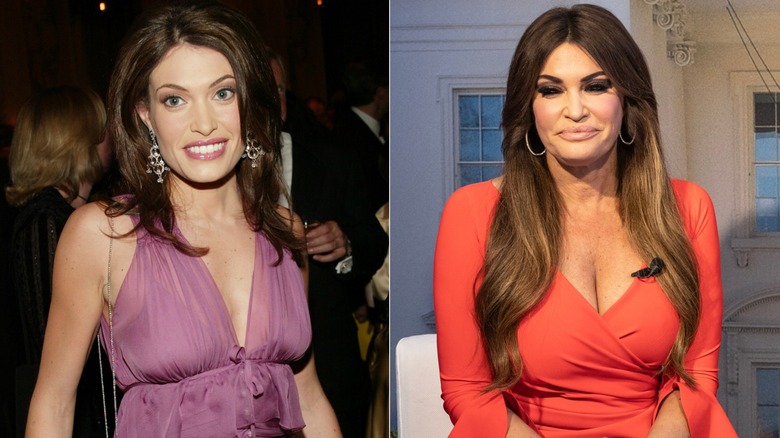 Composite image of Kimberly Guilfoyle before and after extensions