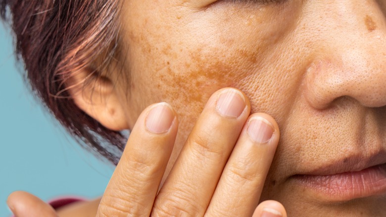 Woman touching her face